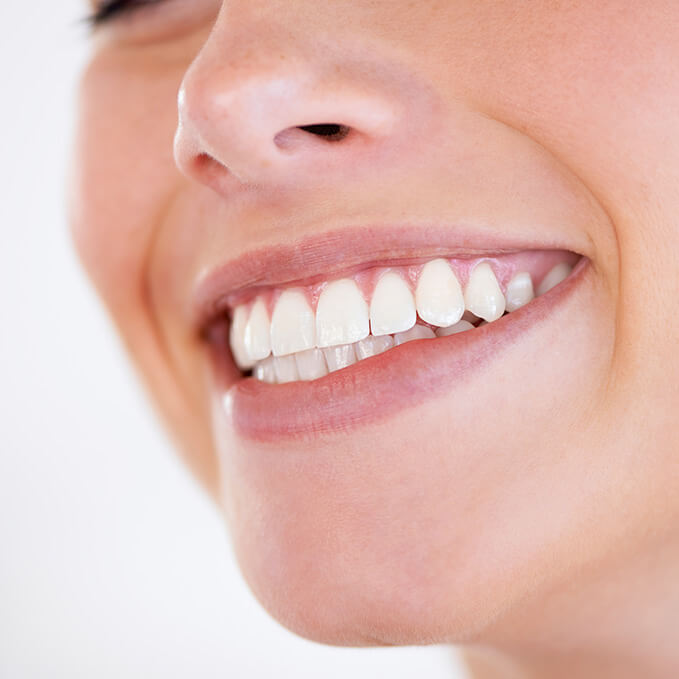 a woman showing off her straight teeth with a smile